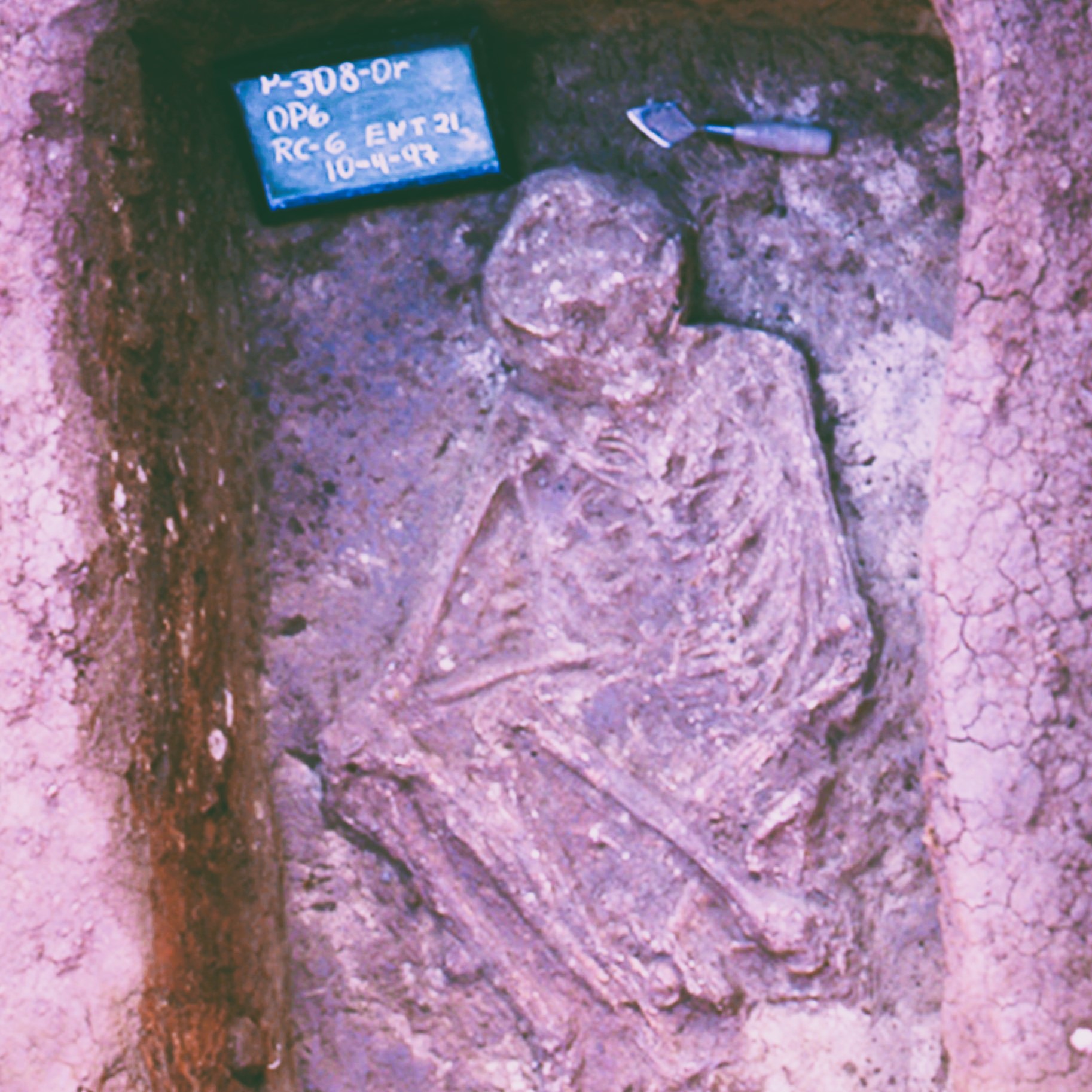 Entierro 21 documentado en el montículo 7 de Orocú, fosa excavada con individuo enterrado en posición flexionada y sin ofrendas. Foto colección del Museo Nacional de Costa Rica (1997), modificaciones por J. Fallas (2023).