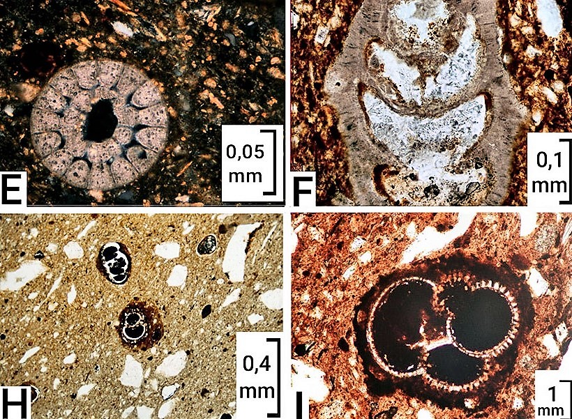 Bioclastos: E) Alga verde (dasicladácea), recristalizada a microesparita equigranular, a nícoles cruzados. F) Detalle de un gastrópodo con la concha micrítica parcialmente recristalizada a microesparita equigranular, las cámaras internas están parcialmente rellenas de arcilla (manchas marrón rojizo, muestra 8011-DZ); H) Globigerinoides, en preservación móldica, las conchillas calcáreas desaparecieron y el molde se observa a causa del relleno de sus cámaras por hematita y el halo que los rodea (muestra 8031-DZ). I) Globigerinoide mostrando los detalles claros de los forámenes, sus cámaras y la conchilla. La concha, está rodeada por un halo y rellenada por hematita (8024-TS).