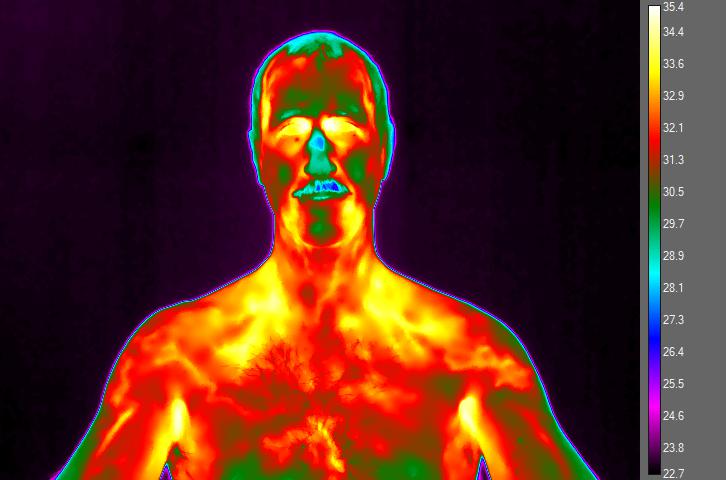 Imagen termográfica